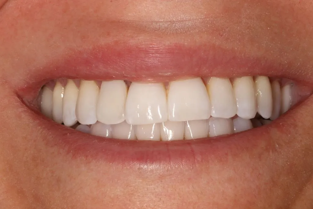 dental financing at dental office in sacramento, ca